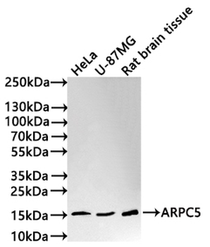 ARPC5 Antibody