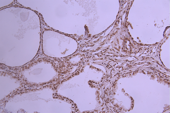 ELAVL1 Antibody