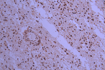 TARDBP Antibody