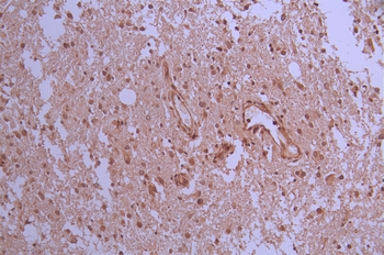 MAP2K6/MAP2K3 Antibody