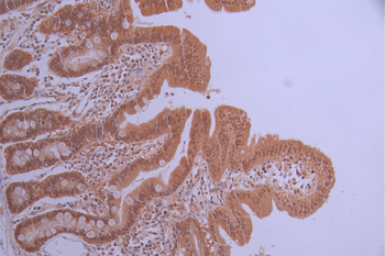 MAP2K6/MAP2K3 Antibody