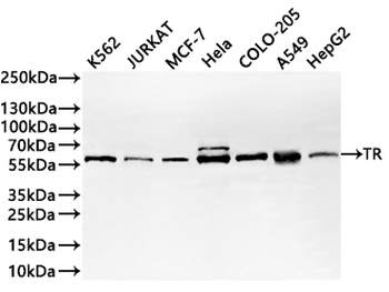 TXNRD1 Antibody