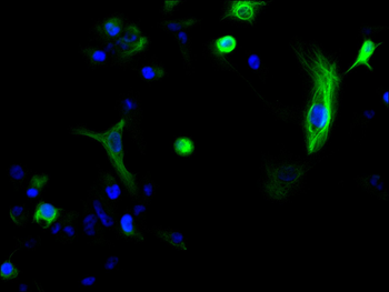 TXNRD1 Antibody