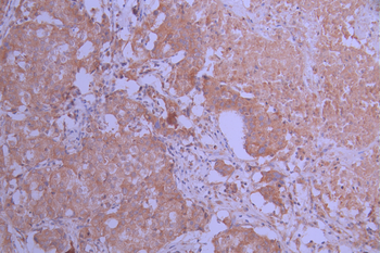 PPP1R1A Antibody
