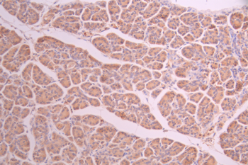 PPP1R1A Antibody