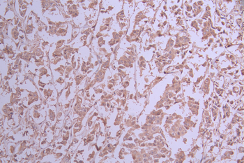 UQCRFS1 Antibody