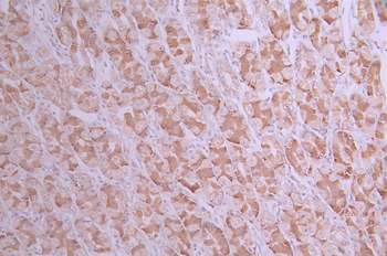 UQCRFS1 Antibody