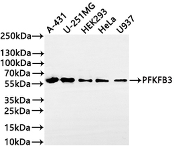 PFKFB3 Antibody