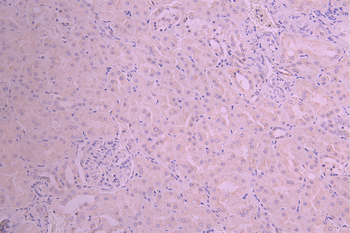 PFKFB3 Antibody
