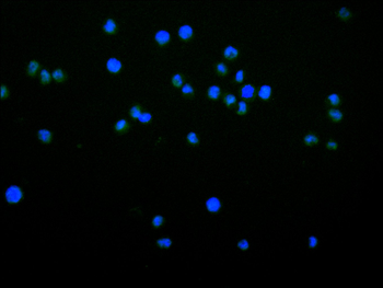 PFKFB3 Antibody