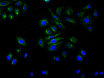 IGF2R Antibody