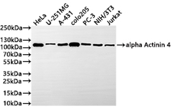 ACTN4 Antibody