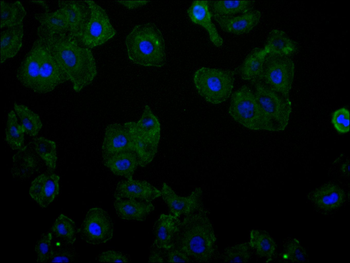 ACTN4 Antibody