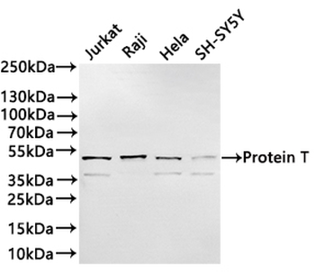 TBXT Antibody