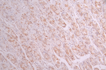 HAT1 Antibody
