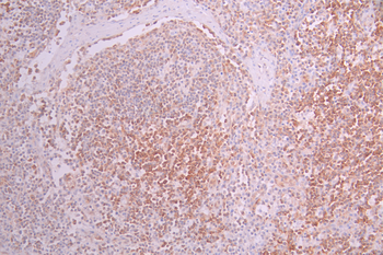 STAT5A/STAT5B Antibody