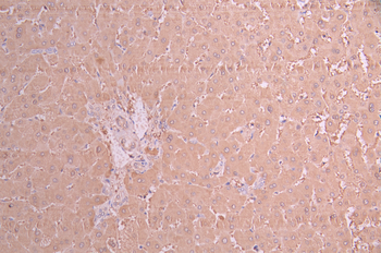 ALDH1A1 Antibody