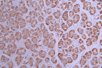 ALDH1A1 Antibody