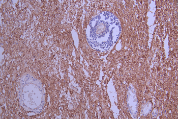 TUBA4A/TUBA1B Antibody