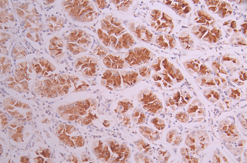 TUBA4A/TUBA1B Antibody