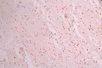 PMS2 Antibody