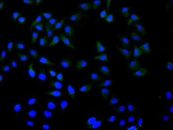 S100A4 Antibody