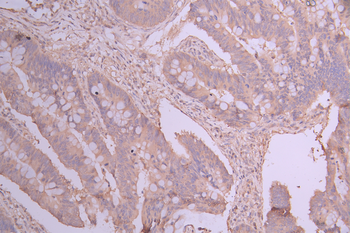 DSTN Antibody