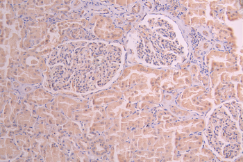 DSTN Antibody