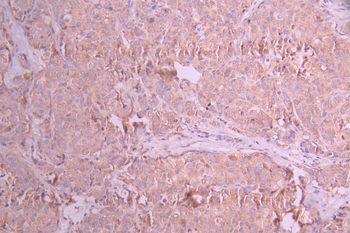 SDHA Antibody