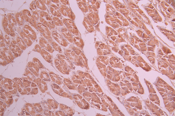 SDHA Antibody