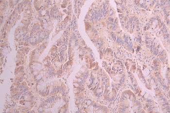 SEC61A1/SEC61A2 Antibody
