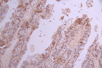 PSMA1 Antibody