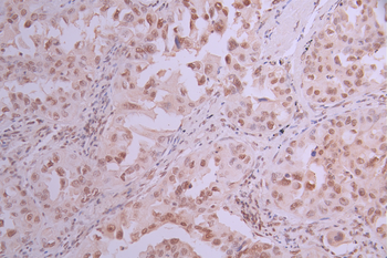 METTL3 Antibody