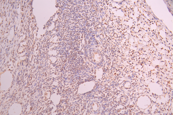 HDAC8 Antibody