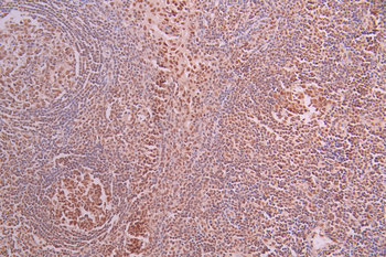 HDAC8 Antibody