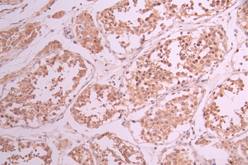 RAD51 Antibody