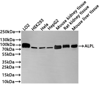 ALPL Antibody