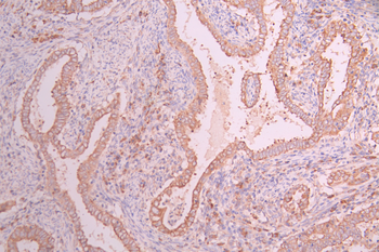 ALPL Antibody