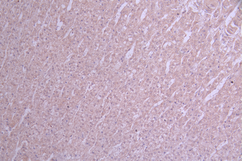 ALPL Antibody