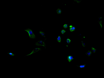 ALPL Antibody