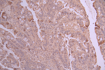 CALM3/CALM2/CALM1 Antibody