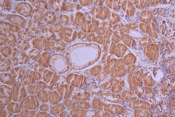 TBPL1 Antibody
