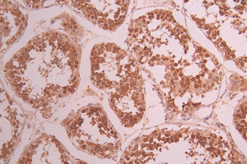 TBPL1 Antibody