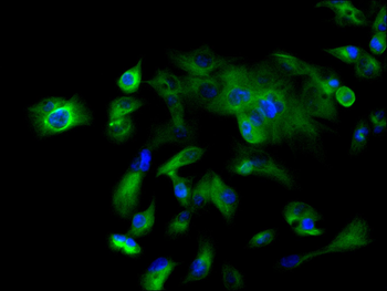 TBPL1 Antibody