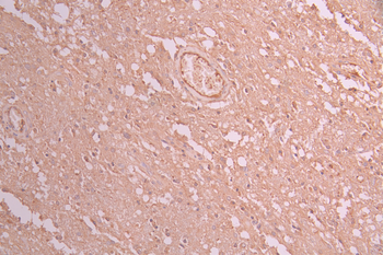 NDUFAF1 Antibody