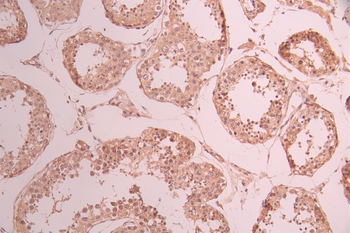 CDKN2A Antibody