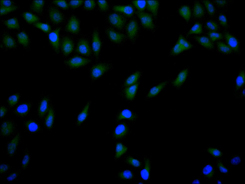 CDKN2A Antibody