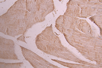 PKM Antibody