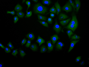 PKM Antibody
