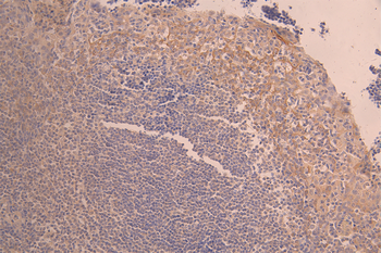 IL6 Antibody